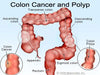How To Cleanse The Colon Naturally